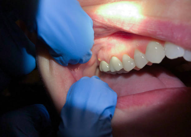 Best Emergency Root Canal Therapy in Lake Orion, MI